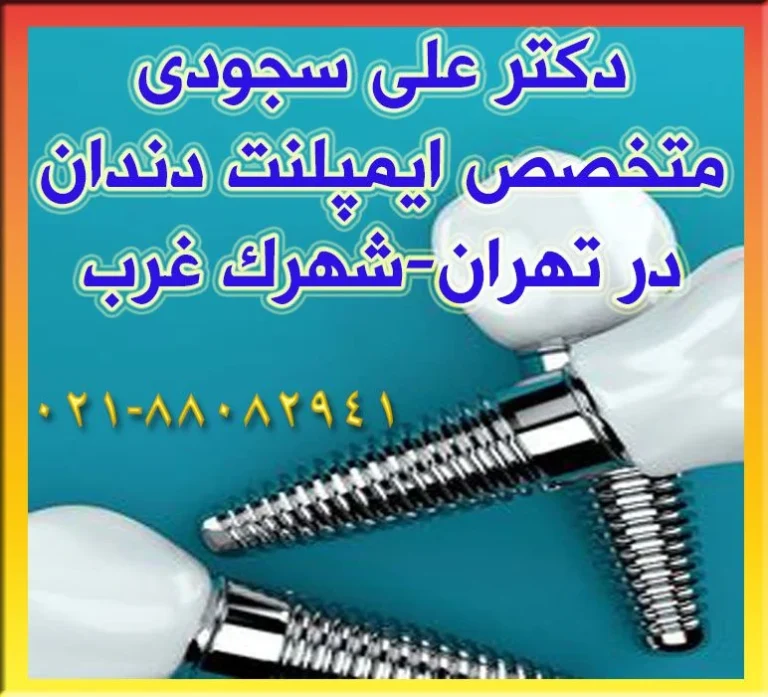 بهترین متخصص ایمپلنت کیست؟