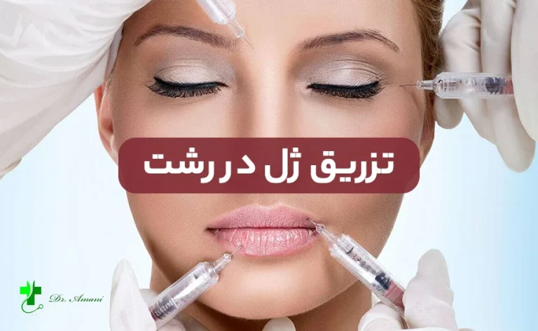 هزینه و قیمت تزریق ژل در رشت ( صورت و لب )