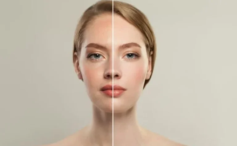 بهترین کرم پودرهای فاقد چربی برای پوست چرب و جوش دار