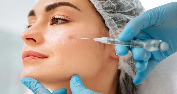 Side effects of fat injection in the face