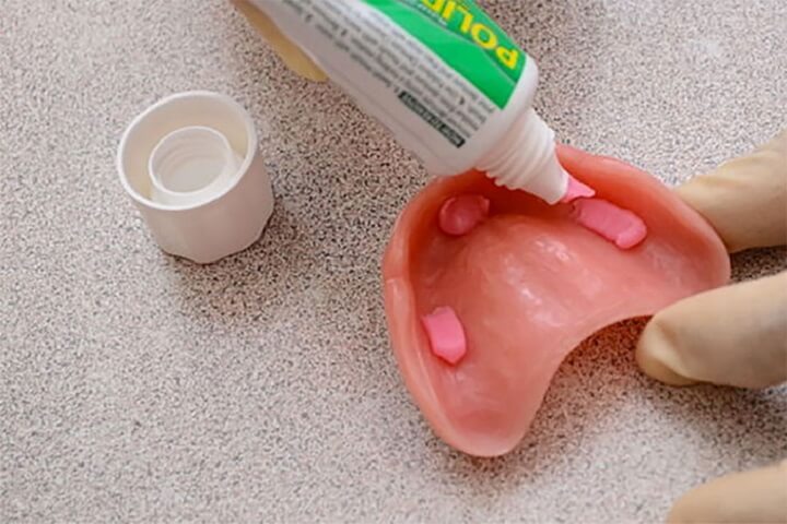 What is denture adhesive and how to use it