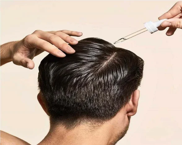 Are the therapeutic effects of minoxidil permanent or temporary?