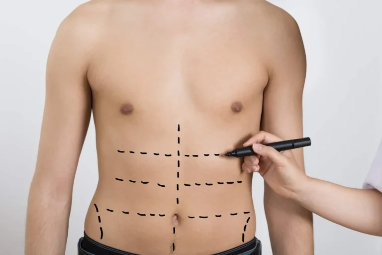 بی حسی بعد از لیپوماتیک