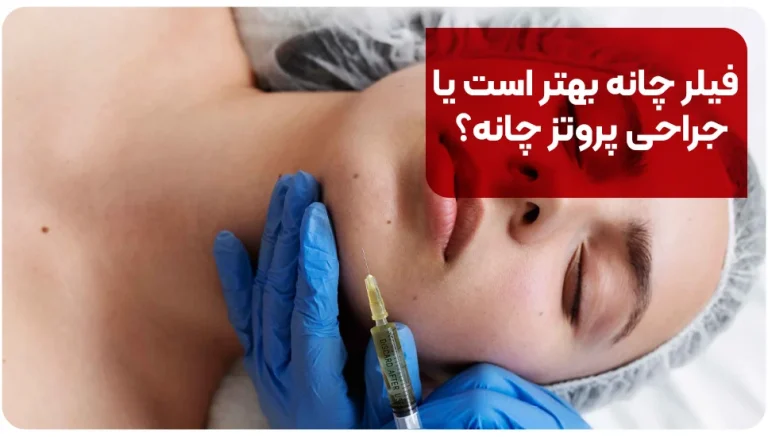 فیلر چانه بهتر است یا جراحی پروتز چانه؟
