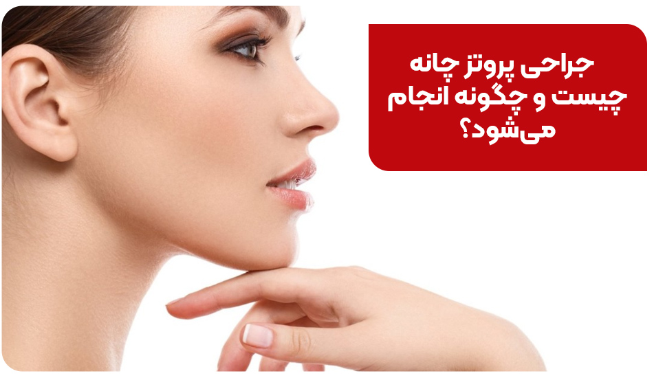 جراحی پروتز چانه چیست و چگونه انجام می‌شود؟