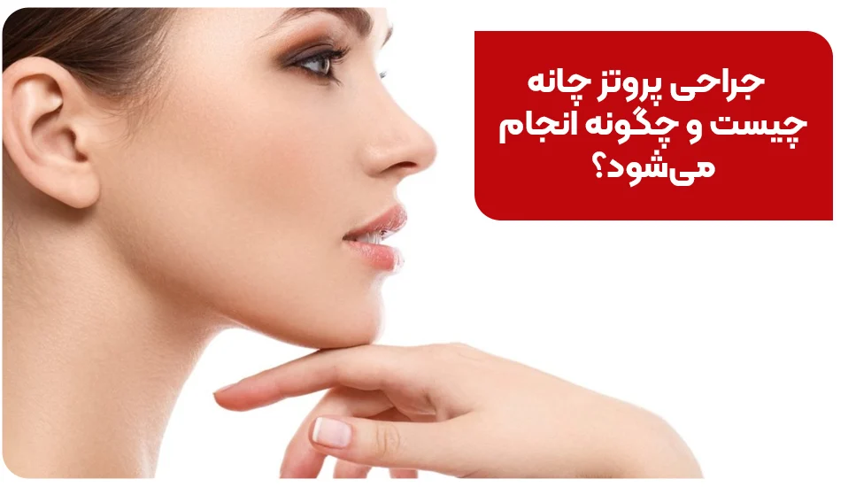 جراحی پروتز چانه چیست و چگونه انجام می&zwnj;شود؟