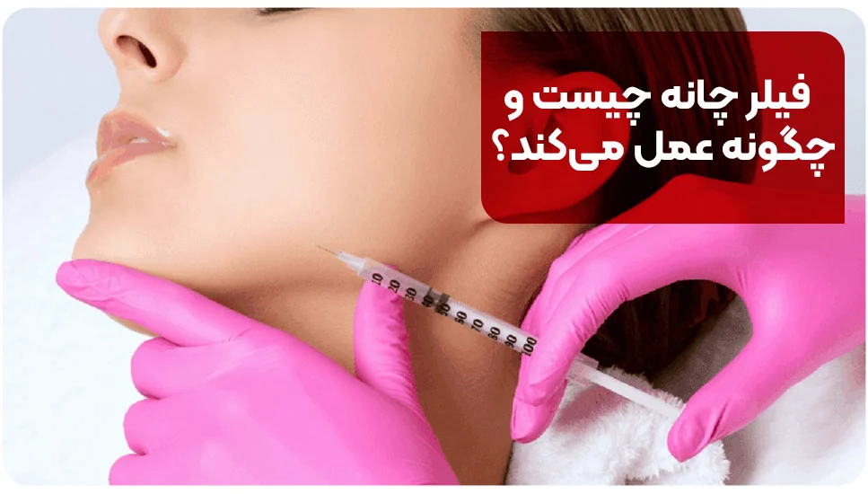 فیلر چانه چیست و چگونه عمل می&zwnj;کند؟