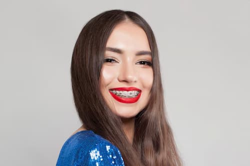 شکستن براکت ارتودنسی یا درآمدن سیم
